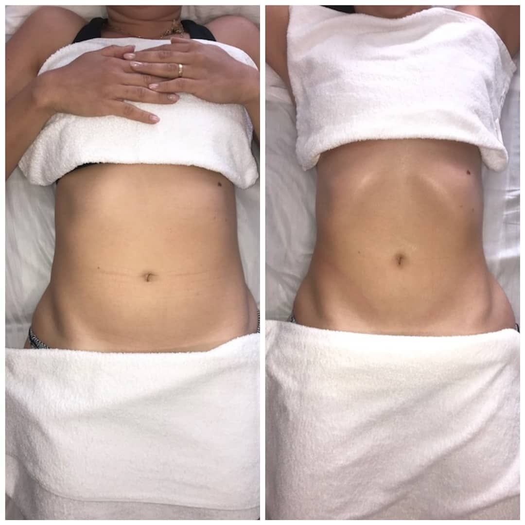 Massage & Body — Adore Beauty Lounge