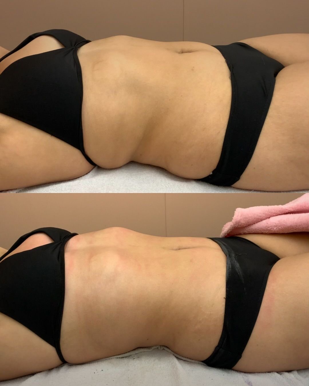 Massage & Body — Adore Beauty Lounge
