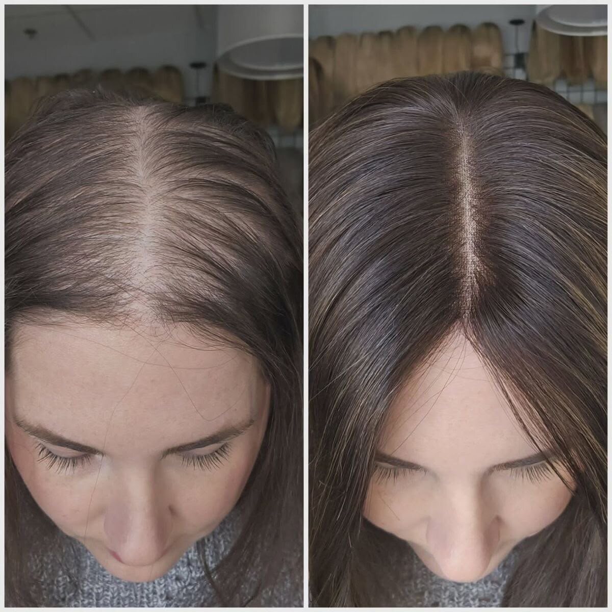 Hair Toppers